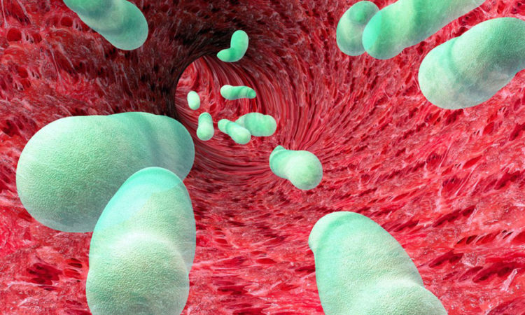 Descuidar los procesos infecciosos aumenta el riesgo de sepsis - Ser